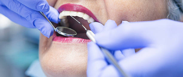 Best Root Canal Emergency Dentist  in Wichita, KS